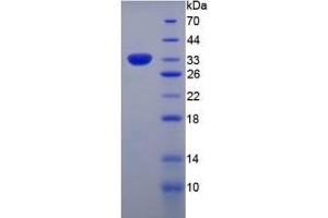 SDS-PAGE of Protein Standard from the Kit  (Highly purified E. (COL7A1 ELISA Kit)