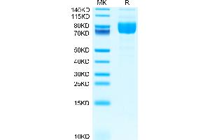 MAG Protein (AA 20-516) (His tag)