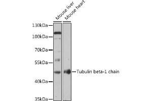 Western blot analysis of extracts of various cell lines, using Tubulin beta-1 chain antibody (ABIN7271046) at 1:1000 dilution. (TUBB1 antibody  (AA 362-451))