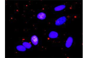 Proximity Ligation Assay (PLA) image for anti-Nuclear Factor-kB p65 (NFkBP65) (AA 432-505) antibody (ABIN562624)