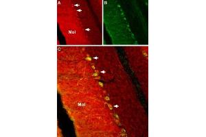 Expression of NaVβ2 in rat cerebellumImmunohistochemical staining of rat cerebellum using Anti-SCN2B (NaVβ2) Antibody (ABIN7581959).