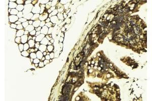 ABIN6277426 at 1/100 staining Mouse colon tissue by IHC-P.