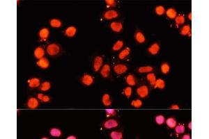 Immunofluorescence analysis of HeLa cells using XRCC1 Polyclonal Antibody at dilution of 1:100 (40x lens).
