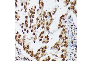 Immunohistochemistry (IHC) image for anti-Heterogeneous Nuclear Ribonucleoprotein D (HNRNPD) (AA 1-306) antibody (ABIN7267632)