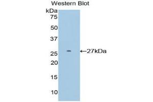 Western blot analysis of the recombinant protein. (DIXDC1 antibody  (AA 513-711))