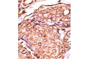 Image no. 1 for anti-Jun Proto-Oncogene (JUN) (pSer63) antibody (ABIN358110)