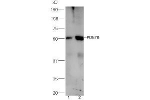 Lane 1:mouse liver lysates Lane 2:mouse brain probed with Rabbit Anti-PDE7B Polyclonal Antibody, Unconjugated (ABIN1386171) at 1:300 overnight at 4 °C. (PDE7B antibody  (AA 281-360))