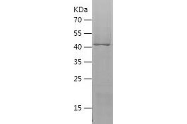 VNN2 Protein (AA 279-492) (His-IF2DI Tag)