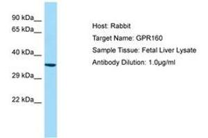 Image no. 1 for anti-G Protein-Coupled Receptor 160 (GPR160) (AA 40-89) antibody (ABIN6750006)