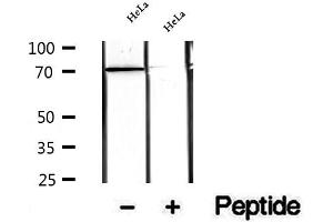 Western blot analysis of extracts of HeLa cells, using WDR46 antibody. (WDR46 antibody  (Internal Region))