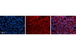 Rabbit Anti-LBP Antibody   Formalin Fixed Paraffin Embedded Tissue: Human Liver Tissue Observed Staining: Cytoplasm and plasma membrane in endothelial cells in sinusoids Primary Antibody Concentration: 1:100 Other Working Concentrations: 1:600 Secondary Antibody: Donkey anti-Rabbit-Cy3 Secondary Antibody Concentration: 1:200 Magnification: 20X Exposure Time: 0. (LBP antibody  (C-Term))