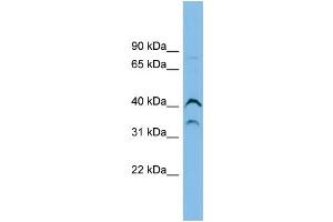 WB Suggested Anti-ASB7 Antibody Titration: 0. (ASB7 antibody  (Middle Region))
