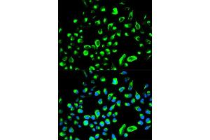 Immunofluorescence analysis of HeLa cell using YWHAQ antibody. (14-3-3 theta antibody  (AA 1-245))