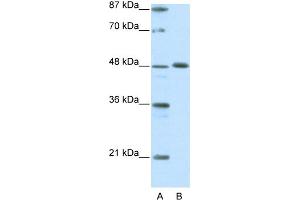 WB Suggested Anti-ZNF259 Antibody Titration:  0. (ZNF259 antibody  (C-Term))