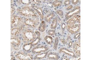 ABIN6266622 at 1/100 staining human kidney tissue sections by IHC-P. (PDGFRA antibody  (Internal Region))