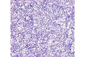 Immunohistochemistry of paraffin-embedded human lymph node tissue using ABIN7174949 at dilution of 1:100 (MYO1G antibody  (AA 209-389))