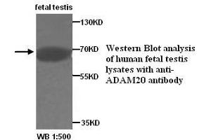 Image no. 1 for anti-ADAM Metallopeptidase Domain 20 (ADAM20) antibody (ABIN1574462) (ADAM20 antibody)