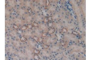 Detection of SGK1 in Mouse Kidney Tissue using Polyclonal Antibody to Serum/Glucocorticoid Regulated Kinase 1 (SGK1) (SGK1 antibody  (AA 145-386))