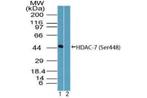 Image no. 1 for anti-Histone Deacetylase 7 (HDAC7) (AA 443-452) antibody (ABIN960196) (HDAC7 antibody  (AA 443-452))