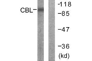 Immunohistochemistry analysis of paraffin-embedded human breast carcinoma tissue using CBL (Ab-700) antibody. (CBL antibody  (Tyr700))