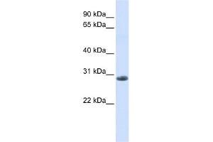 YIPF6 antibody used at 1 ug/ml to detect target protein. (YIPF6 antibody  (C-Term))
