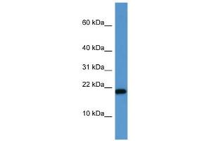 WB Suggested Anti-SH2D1A Antibody Titration: 0. (SH2D1A antibody  (C-Term))