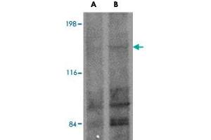 Western blot analysis of FRMPD1 in K-562 cell lysate with FRMPD1 polyclonal antibody  at (A) 1 and (B) 2 ug/mL . (FRMPD1 antibody  (C-Term))