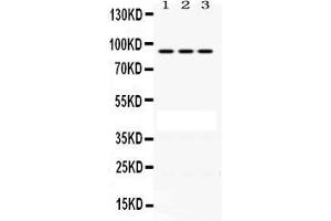 Anti-PRLR Picoband antibody, Western blotting All lanes: Anti PRLR  at 0. (Prolactin Receptor antibody  (C-Term))
