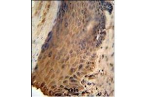 GFPT2 Antibody (Center) (ABIN653230 and ABIN2842763) IHC analysis in formalin fixed and paraffin embedded human skin followed by peroxidase conjugation of the secondary antibody and DAB staining. (GFPT2 antibody  (AA 175-201))