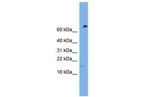 Image no. 1 for anti-Interferon Induced Transmembrane Protein 5 (IFITM5) (C-Term) antibody (ABIN6744785) (IFITM5 antibody  (C-Term))