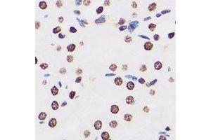 Immunohistochemical analysis of FIR staining in human kidney formalin fixed paraffin embedded tissue section. (FARP2 antibody)
