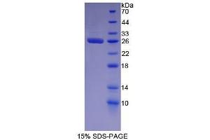 SDS-PAGE (SDS) image for Glutathione S-Transferase alpha 2 (GSTa2) (AA 1-222) protein (His tag) (ABIN1079683)
