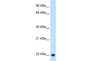 WB Suggested Anti-KLKB1 Antibody Titration:  2. (KLKB1 antibody  (Middle Region))