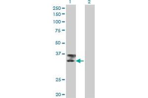 Western Blot analysis of TTN expression in transfected 293T cell line by TTN monoclonal antibody (M09), clone 6H5. (Titin antibody  (AA 1-110))