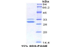 SDS-PAGE (SDS) image for High Mobility Group Box 1 (HMGB1) (AA 1-215) protein (His tag) (ABIN1079871) (HMGB1 Protein (AA 1-215) (His tag))