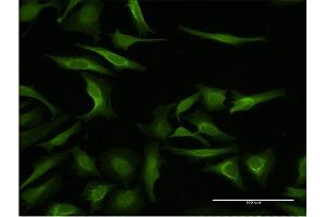Immunofluorescence of monoclonal antibody to MAGEA3 on HeLa cell. (MAGEA3 antibody  (AA 44-114))