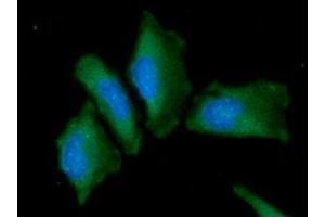ICC/IF analysis of AFP in HaLe cells. (alpha Fetoprotein antibody  (AA 19-609))