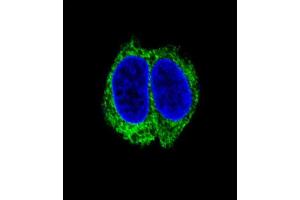 Confocal immunofluorescent analysis of TGFBR2 Antibody (N-term) with HepG2 cell followed by Alexa Fluor 488-conjugated goat anti-rabbit lgG (green).