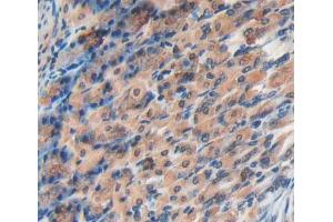Used in DAB staining on fromalin fixed paraffin- embedded stomach tissue (EPRS antibody  (AA 1007-1512))
