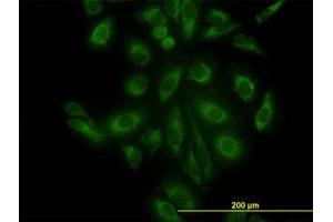 Image no. 3 for anti-ARP3 Actin-Related Protein 3 (ACTR3) (AA 1-419) antibody (ABIN599115) (ACTR3 antibody  (AA 1-419))
