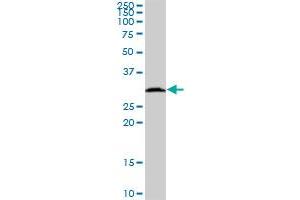 HSD17B8 MaxPab polyclonal antibody. (HSD17B8 antibody  (AA 1-261))
