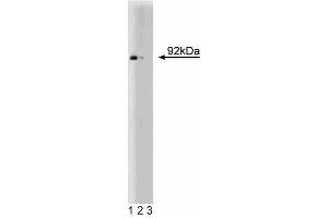 Western blot analysis of Stat5 on human endothelial cell lysate. (STAT5A antibody  (AA 451-649))