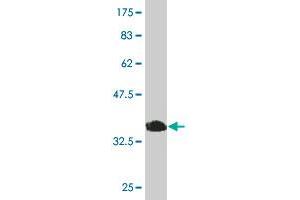 Western Blot detection against Immunogen (36. (MYLK2 antibody  (AA 161-260))