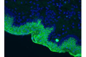 Image no. 2 for anti-Keratin 10 (KRT10) antibody (ABIN335328) (Keratin 10 antibody)
