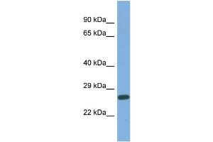 Host:  Rabbit  Target Name:  MED25  Sample Type:  OVCAR-3 Whole Cell lysates  Antibody Dilution:  1.