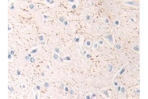 Detection of MAP2K1 in Human Cerebrum Tissue using Polyclonal Antibody to Mitogen Activated Protein Kinase Kinase 1 (MAP2K1) (MEK1 antibody  (AA 54-369))