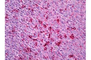 anti-Cathepsin S (CTSS) antibody