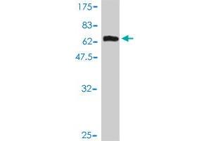 Western Blot detection against Immunogen (60. (MAGEA8 antibody  (AA 1-318))