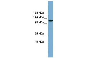 SLC12A5 antibody used at 1 ug/ml to detect target protein. (KCC2 antibody)