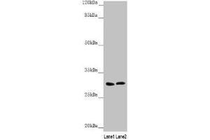Western blot All lanes: SNAP29 antibody at 1. (SNAP29 antibody  (AA 1-258))